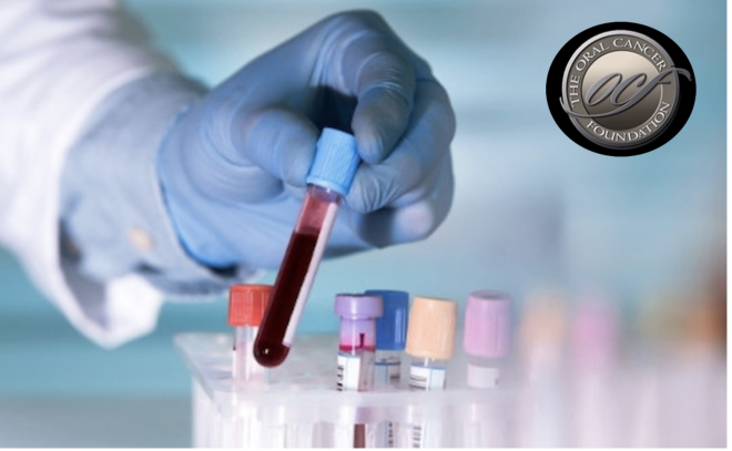 Exame de sangue para 50 tipos de cancro pode acelerar diagnóstico