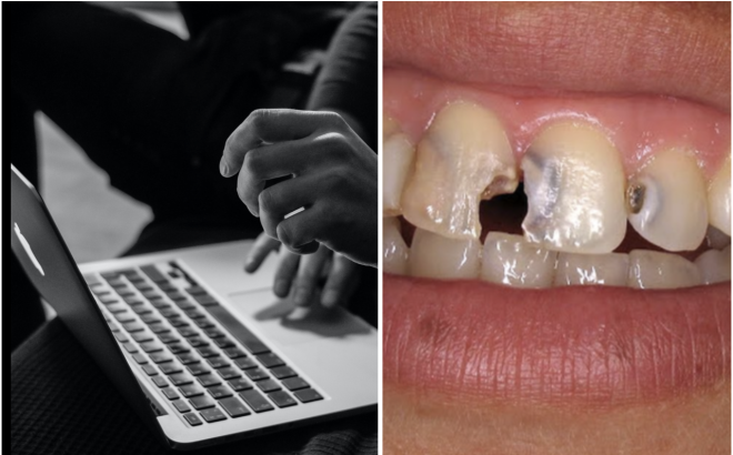 Cárie dentária em adolescentes japoneses associada ao vício da Internet
