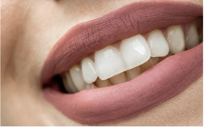 Gel à base de proteínas restaura o esmalte dentário e pode impulsionar a reparação dos dentes