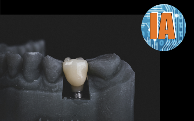 A IA ajuda a prever os resultados do tratamento para pacientes com problemas nos implantes dentários