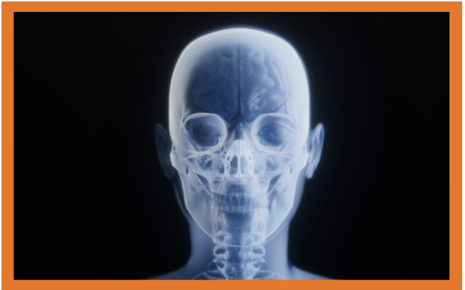 Radiografias Deepfake geradas  com IA criam vulnerabilidade no diagnóstico por imagem
