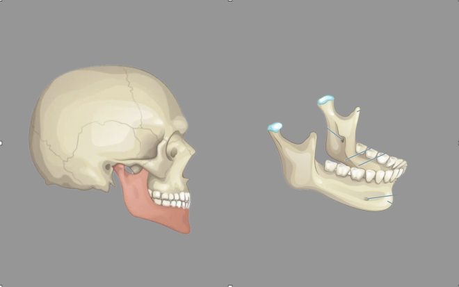 Andaimes impressos em 3D utilisando design personalizado para reconstruir ossos da mandíbula