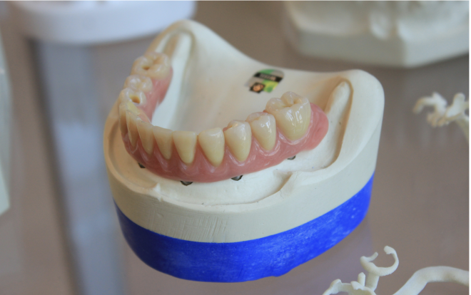 Investigação inovadora capta as realidades emocionais e sociais dos utilizadores de próteses dentárias