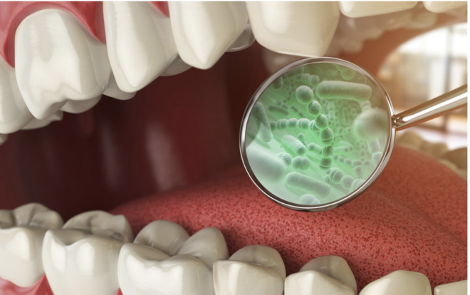 Compreender as bactérias orais para ajudar a combater a doença periodontal
