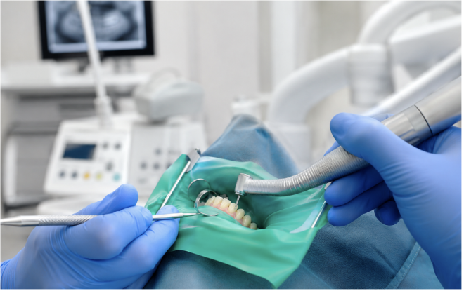 Extrato de curcuma e gengibre pode fortalecer a adesão dos implantes e eliminar 92% das bactérias