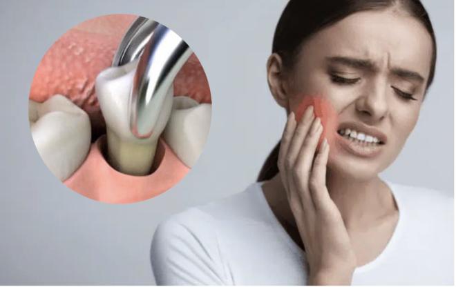 Alternativa promissora aos opióides para a dor após extrações dentárias
