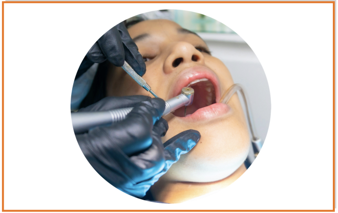 Estudo revela que o microbioma oral dita efeito do amido nas cáries,