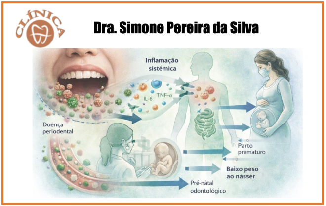 Quando a gengiva fala pelo corpo: Doença periodontal, gestação e parto prematuro