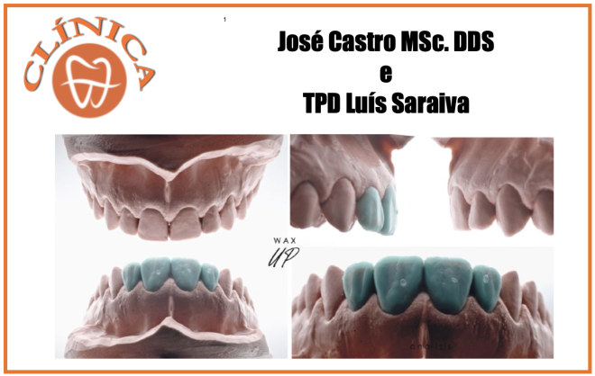 “Team Work” Facetas - Dr. José Castro; TPD-Luís Saraiva (Claraty Lab)
