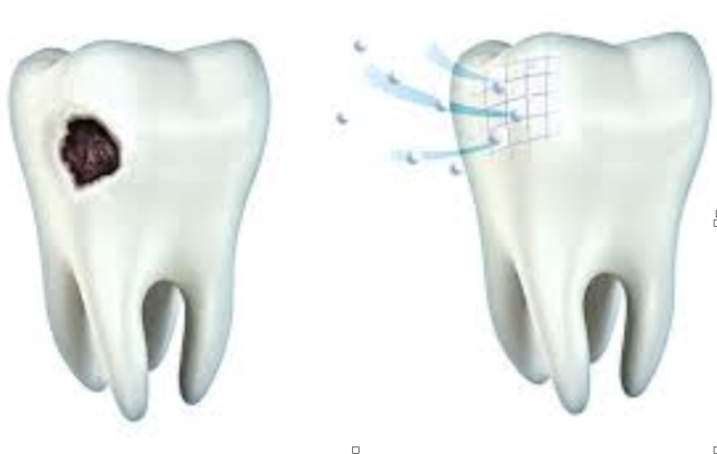 Um passo importante para o desenvolvimento do esmalte dentário biológico