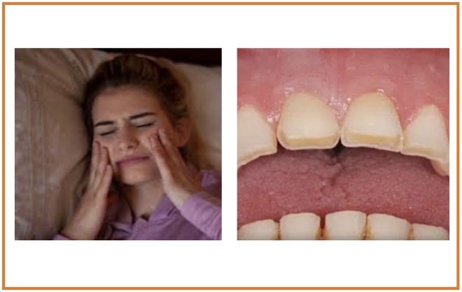 Distúrbios temporomandibulares - Distúrbios da boca e dos dentes