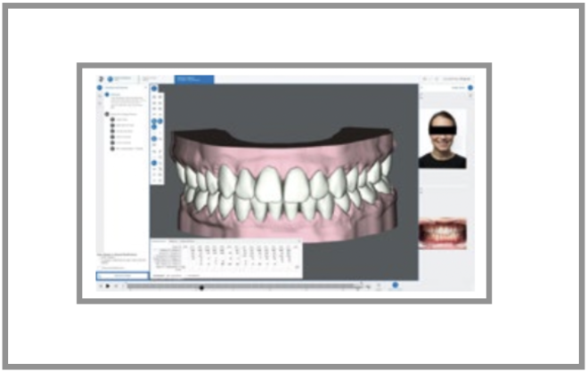 Dentsply Sirona apresenta atualizações SureSmile Aligner Software para uma experiência melhorada