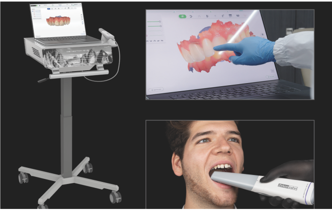 Scanner intraoral Detection Eye de Zirkonzahn para impressões digitais