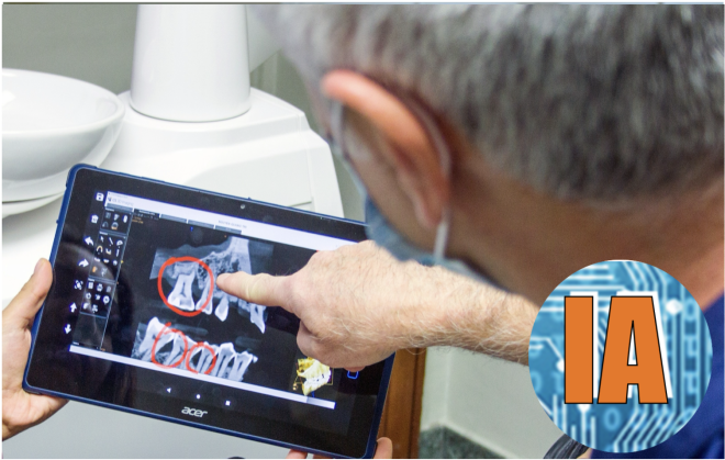 Utilização de IA na deteção precoce do cancro oral