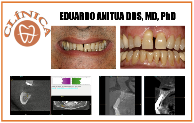 Abordagem multidisciplinar para a resolução de um caso complexo recorrendo a várias áreas da medicina dentária