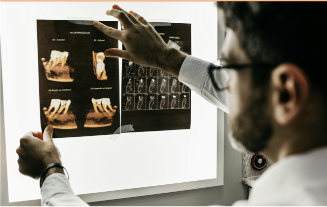 A IA ajuda a prever os resultados do tratamento para pacientes com doença nos implantes dentários