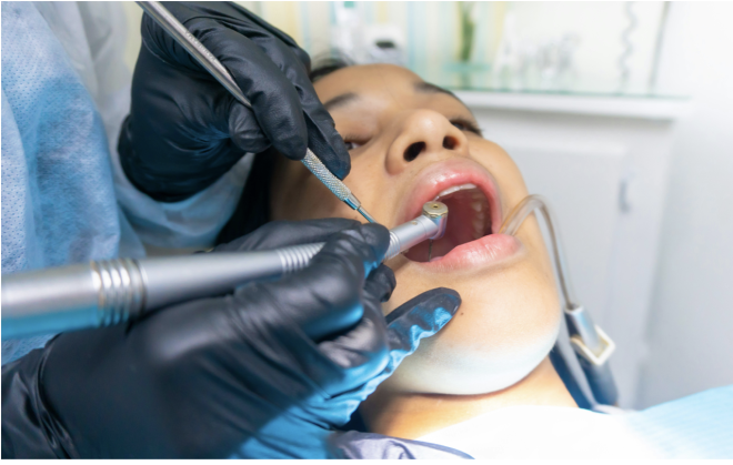 Infeção dentária silenciosa pode estar a prejudicar todo o corpo