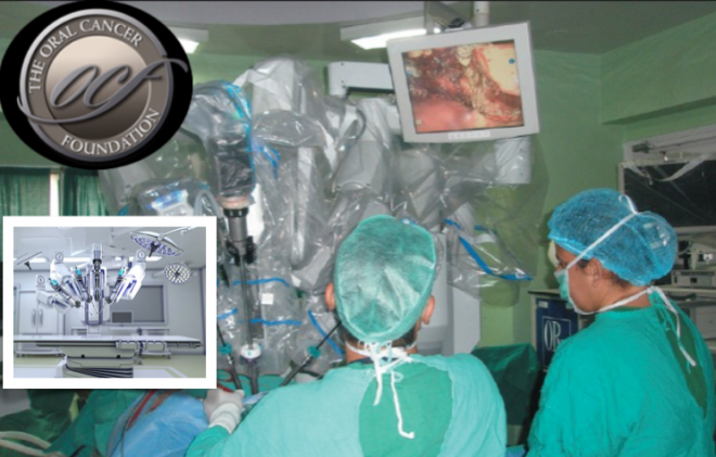A cirurgia transoral robótica reduz o tempo de recuperação do paciente