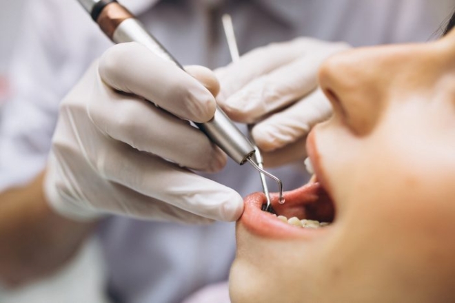 Bons cuidados dentários são fundamentais para a prevenção do AVC