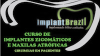 Curso de Implantes Zigomáticos e Maxilas Atróficas