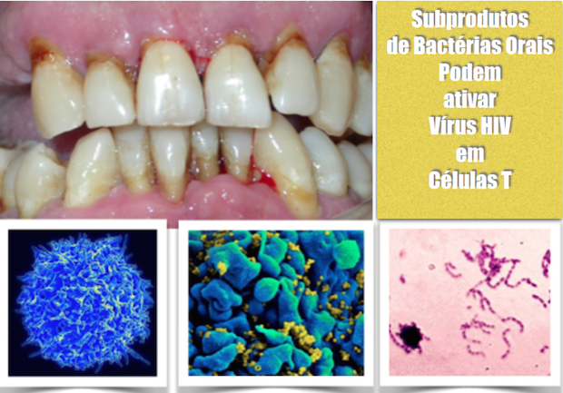   SUBPRODUTOS DE BACTÉRIAS ORAIS PODEM  ATIVAR  OS VÍRUS HIV DORMENTES EM CÉLULAS T 