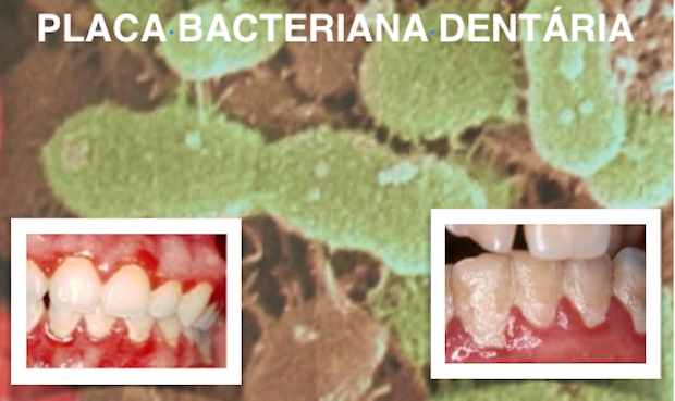 AMINOÁCIDO NATURAL PODE MELHORAR A SAÚDE ORAL