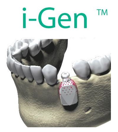 I-GEN