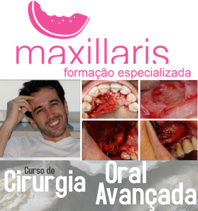 CURSO DE CIRURGIA ORAL AVANÇADA