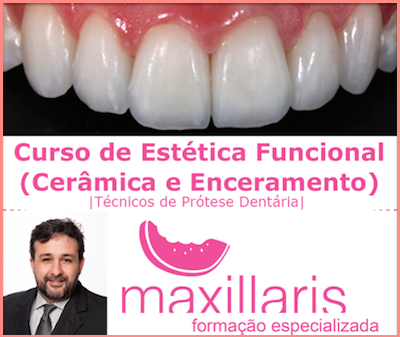 CURSO DE ESTÉTICA FUNCIONAL (CERÂMICA E ENCERAMENTO). DIRECIONADO A |T.P.D.|