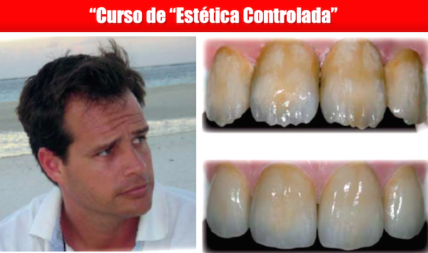 “CURSO DE “ESTÉTICA CONTROLADA” COM O DR. LUIS MAMPEL 