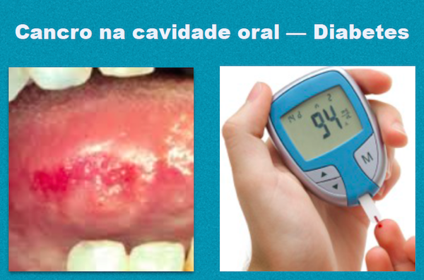 DIABETES AUMENTA O RISCO DE CANCRO NA CABEÇA E PESCOÇO