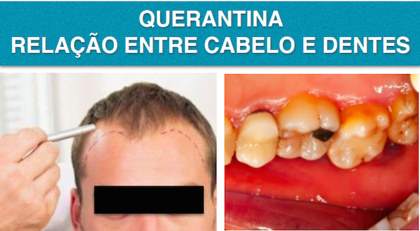 AS QUERATINAS SÃO IMPORTANTES NA ESTRUTURA DO ESMALTE DOS DENTES