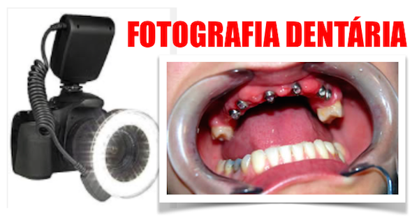 CURSO EXTENSIVO DE FOTOGRAFIA DENTÁRIA E DE FORMA E FUNÇÃO