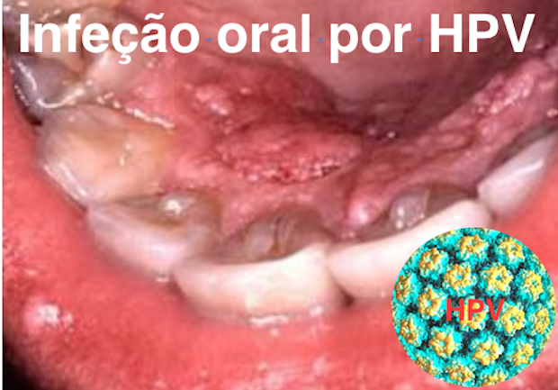 hpv all ano)