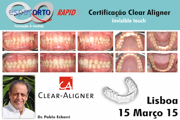 FORMAÇÃO CERTIFICAÇÃO CLEAR ALIGNER