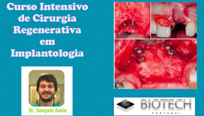 CURSO INTENSIVO DE CIRURGIA REGENERATIVA EM IMPLANTOLOGIA