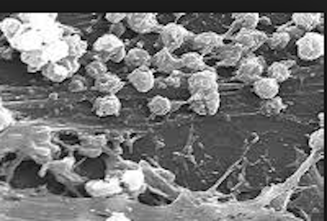 SOCIEDADE CIENTÍFICA (ESCMID) APRESENTA DIRETRIZES PARA LIDAR COM INFEÇÕES PROVOCADAS POR  BIOFILME